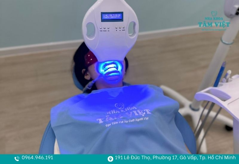 Tẩy trắng răng Laser Whitening tại nha khoa 