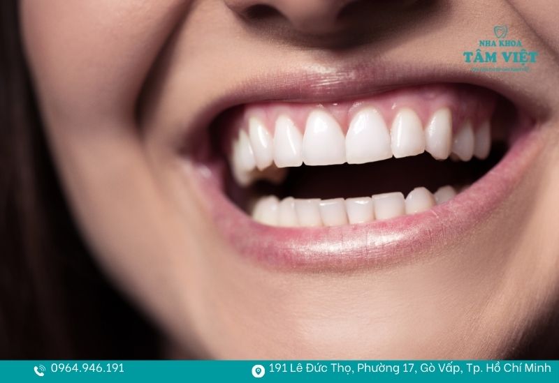 Nụ cười rạng rỡ và sự tự tin tuyệt đối