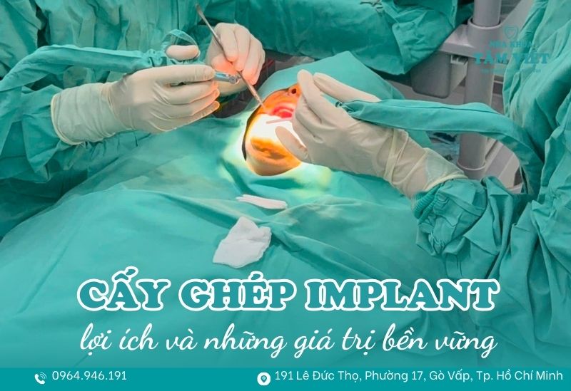 Khám phá lợi ích cấy ghép implant và những giá trị bền vững 1 lợi ích cấy ghép implant