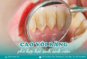 nha khoa cạo vôi răng giá rẻ