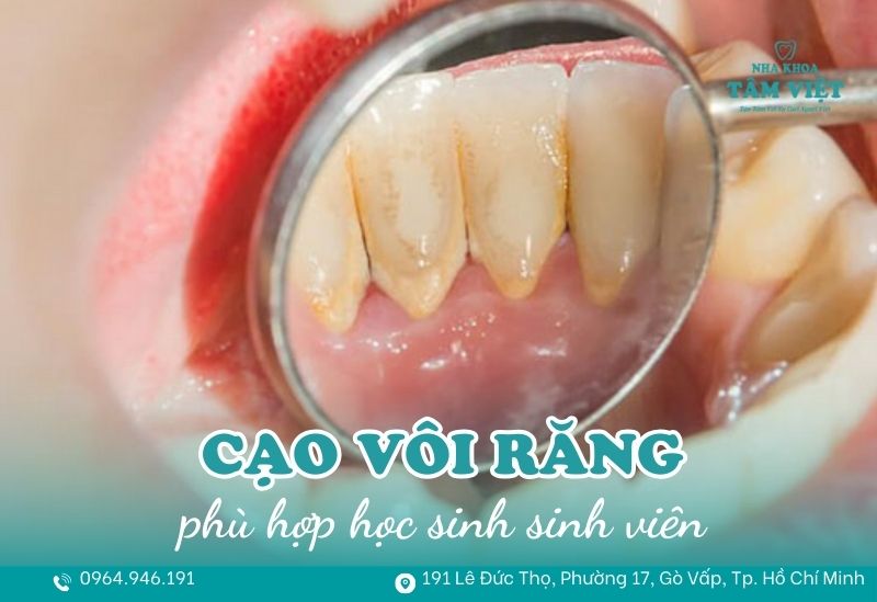 Nha khoa cạo vôi răng giá rẻ phù hợp học sinh sinh viên 1 nha khoa cạo vôi răng giá rẻ