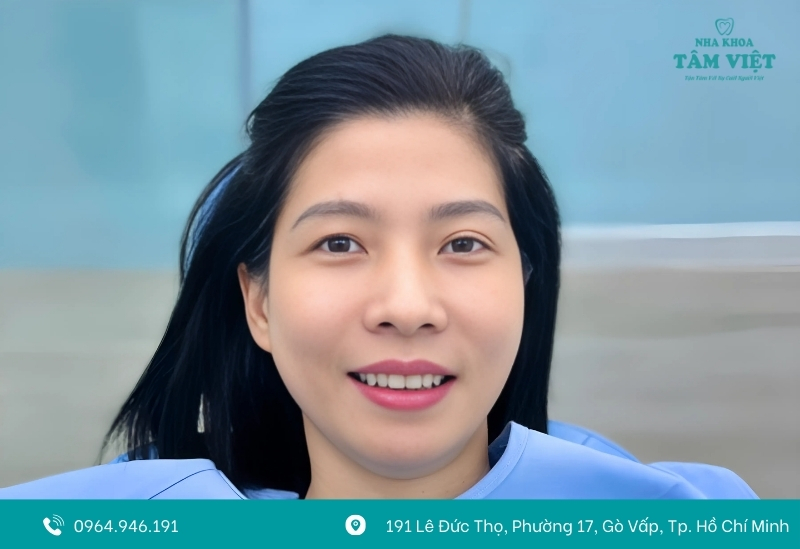 Điều kiện để bọc sứ răng bể lớn