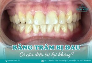 răng trám bị đau khi nhai
