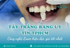 Nha khoa tẩy trắng răng uy tín TPHCM giá tốt