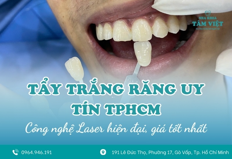 Nha khoa tẩy trắng răng uy tín TPHCM giá tốt 1 Nha khoa tẩy trắng răng uy tín TPHCM giá tốt