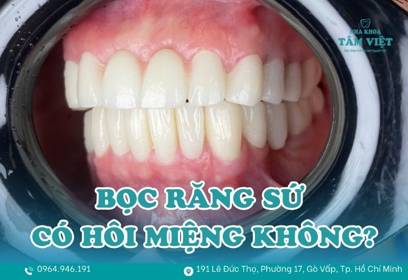 Bọc răng sứ có bị hôi miệng không sau một thời gian sử dụng? 1 bọc răng sứ có bị hôi miệng không