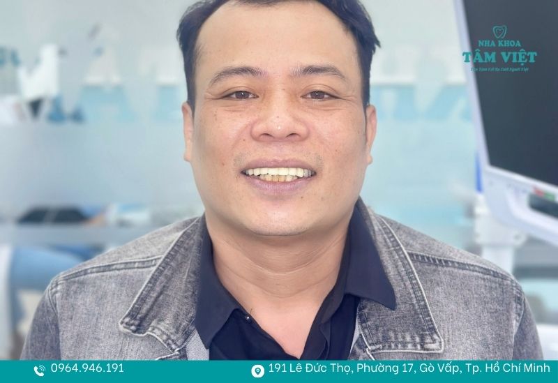 Bọc răng sứ có bị hôi miệng không sau một thời gian sử dụng? 2 Bọc răng sứ không bị hôi miệng