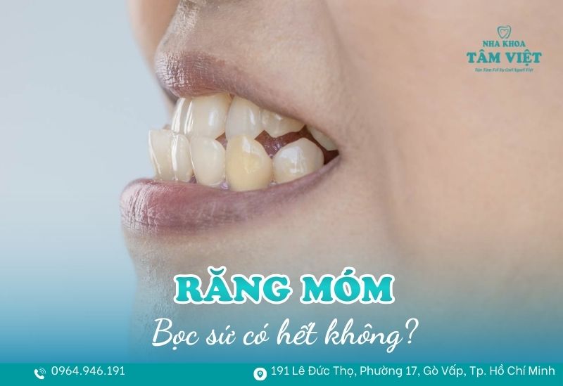 Bọc răng sứ có hết móm không? Hiểu đúng trước khi thực hiện 1 Bọc răng sứ có hết móm không