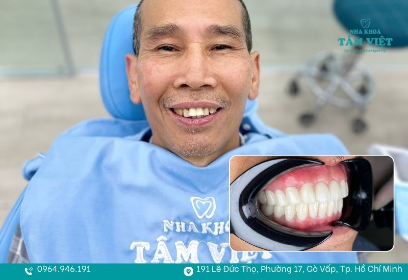 Trải nghiệm bọc răng sứ công nghệ mới TPHCM an toàn, thẩm mỹ 3 Địa chỉ bọc răng sứ công nghệ mới TPHCM uy tín