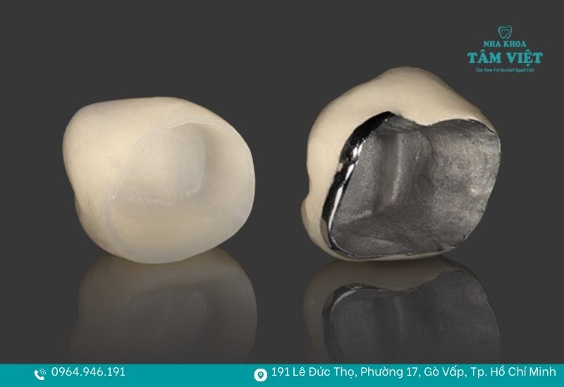 Nên bọc răng sứ loại nào tốt, bền đẹp và giá hợp lý nhất? 2 Răng sứ kim loại