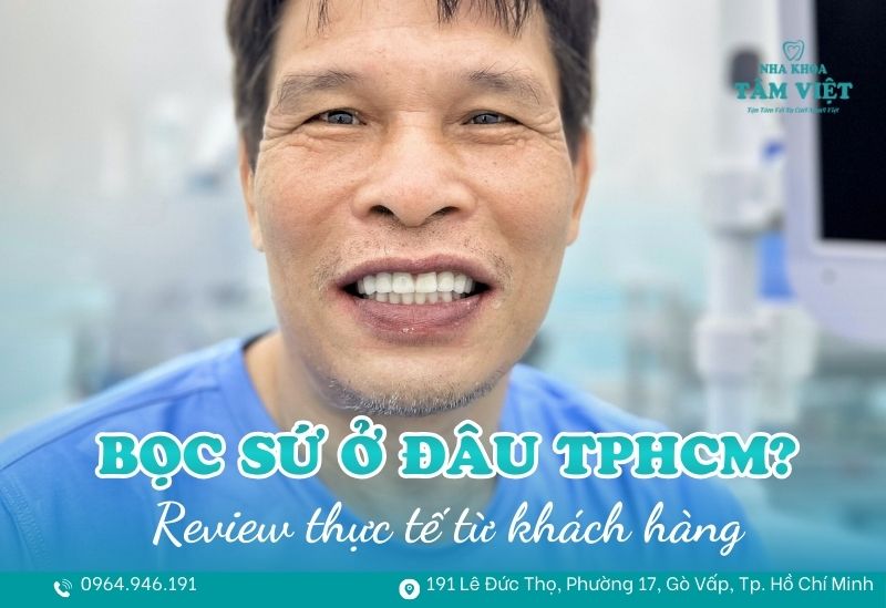Bọc răng sứ ở đâu uy tín TPHCM? Review thực tế từ khách hàng 1 bọc răng sứ ở đâu uy tín TPHCM