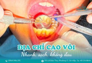 địa chỉ cạo vôi răng gần đây
