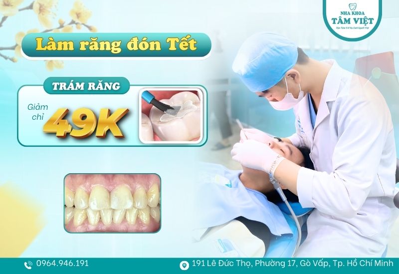 Địa chỉ trám răng “quốc dân” cho sinh viên TPHCM
