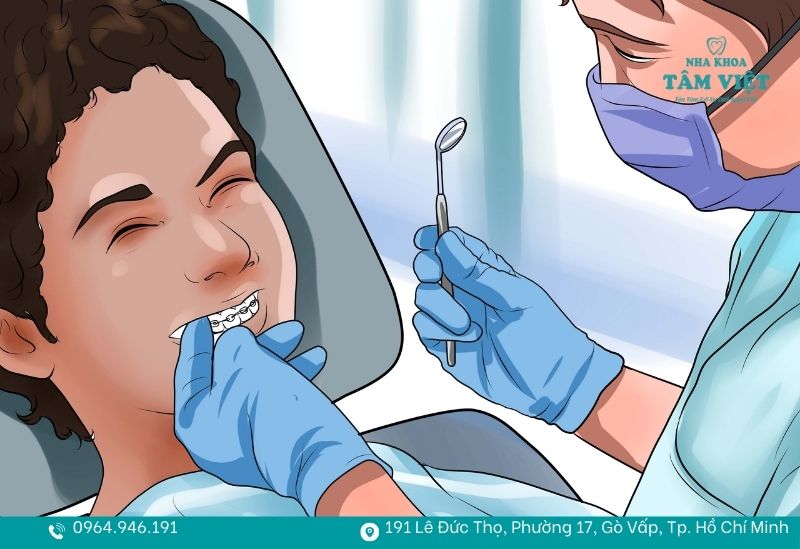 Đang niềng răng có cạo vôi răng được không, có đau không? 2 Niềng răng vẫn cần cạo vôi răng