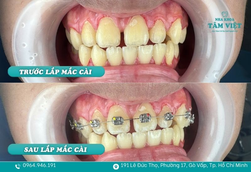 Hành trình thay đổi diện mạo cần sự kiên nhẫn