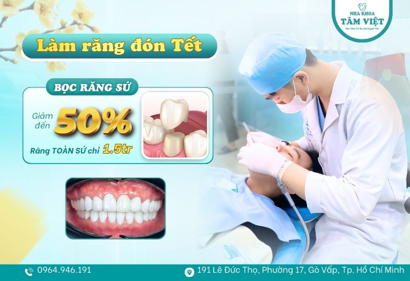 Sự thật răng hô có nên bọc sứ không? Ưu và nhược điểm cần biết 6 Ưu đãi giảm đến 50% dịch vụ bọc răng sứ