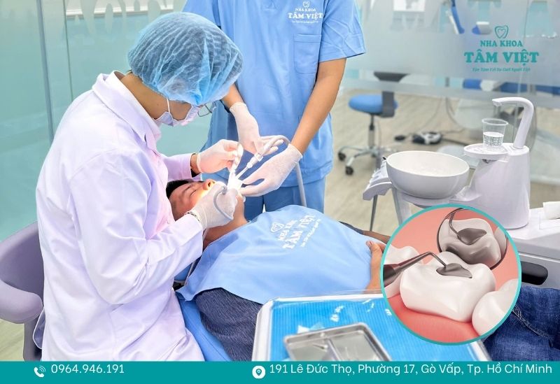 Răng sứ không thể trám lại bằng vật liệu Composite