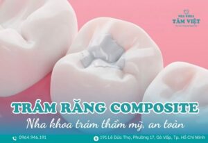 Trám răng composite ở TPHCM