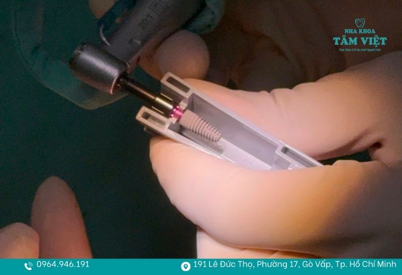 Trồng răng implant cho người cao tuổi có an toàn không? 2 Lợi ích của trồng răng implant