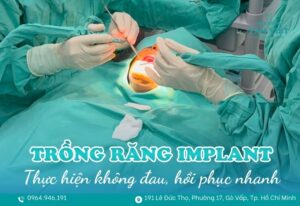 trồng răng implant uy tín Gò Vấp
