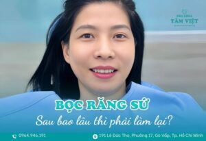 bọc răng sứ bao lâu thì phải làm lại