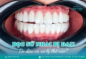 bọc răng sứ xong nhai bị đau