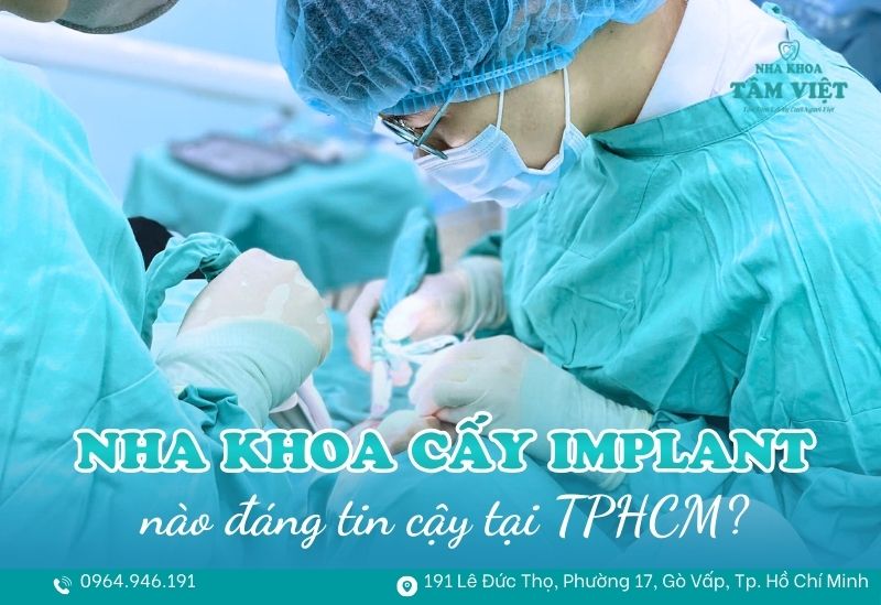 Nha khoa cấy ghép implant