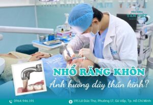 nhổ răng khôn có ảnh hưởng thần kinh không