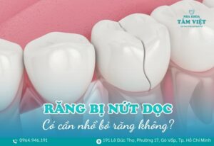 răng bị nứt dọc phải làm sao