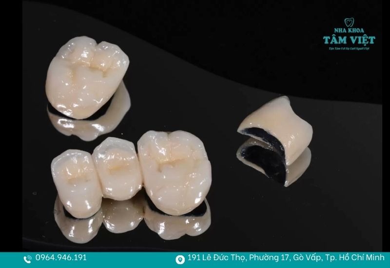 Cấu tạo răng sứ Titan