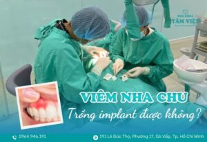 viêm nha chu có trồng răng implant được không
