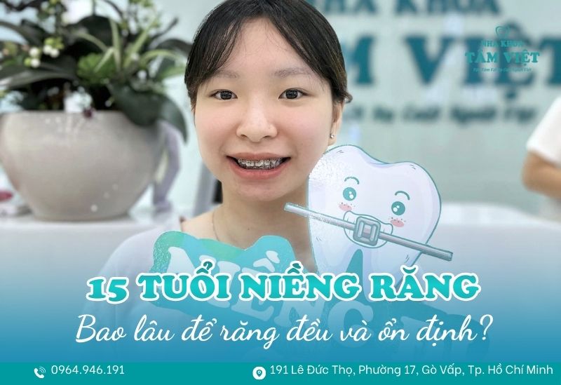 15 tuổi niềng răng bao lâu để răng đều và ổn định? 1 15 tuổi niềng răng bao lâu