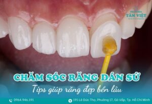 chăm sóc răng dán sứ