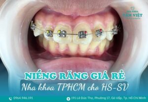 nha khoa niềng răng giá rẻ cho học sinh TPHCM
