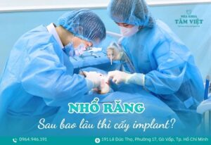 nhổ răng bao lâu thì cấy implant