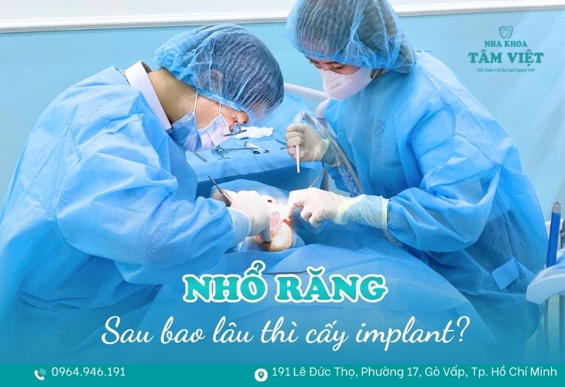 Giải đáp sau nhổ răng bao lâu thì cấy implant là tốt nhất? 1 nhổ răng bao lâu thì cấy implant