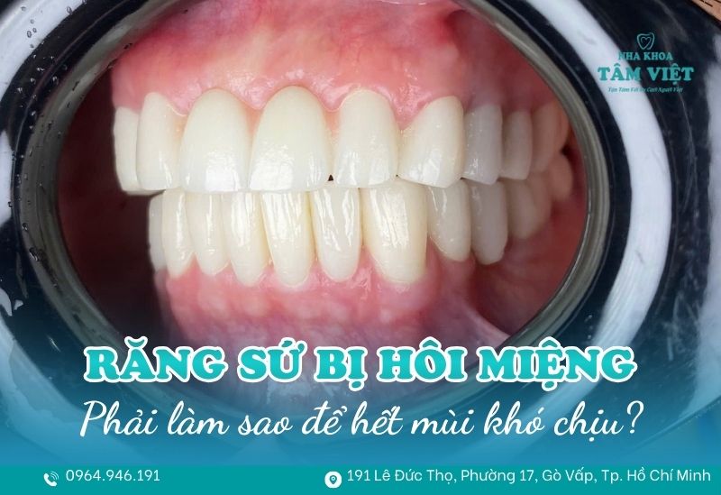 Răng sứ bị hôi miệng phải làm sao để hết mùi khó chịu? 1 răng sứ bị hôi miệng phải làm sao