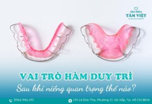 vai trò của hàm duy trì sau khi niềng