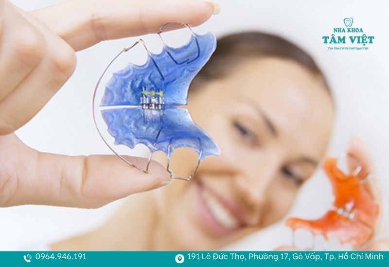 Vai trò của hàm duy trì sau khi niềng quan trọng thế nào? 5 Đeo hàm duy trì bao lâu tuỳ vào tình trạng răng