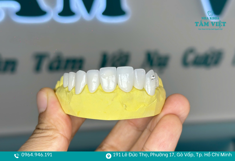 Nha khoa Tâm Việt có rất nhiều dòng răng sứ cao cấp