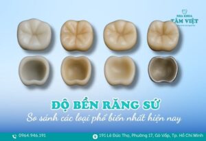 độ bền của các loại răng sứ