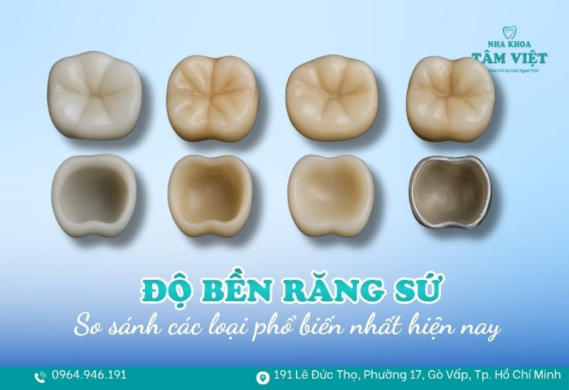 độ bền của các loại răng sứ