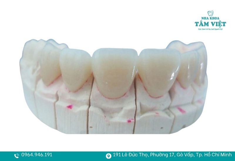 Răng sứ Ceramill