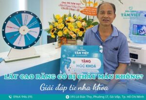 lấy cao răng có bị chảy máu không