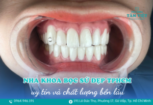 nha khoa bọc sứ đẹp TPHCM