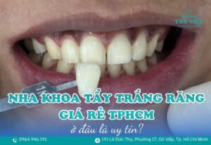 nha khoa tẩy trắng răng giá rẻ TPHCM