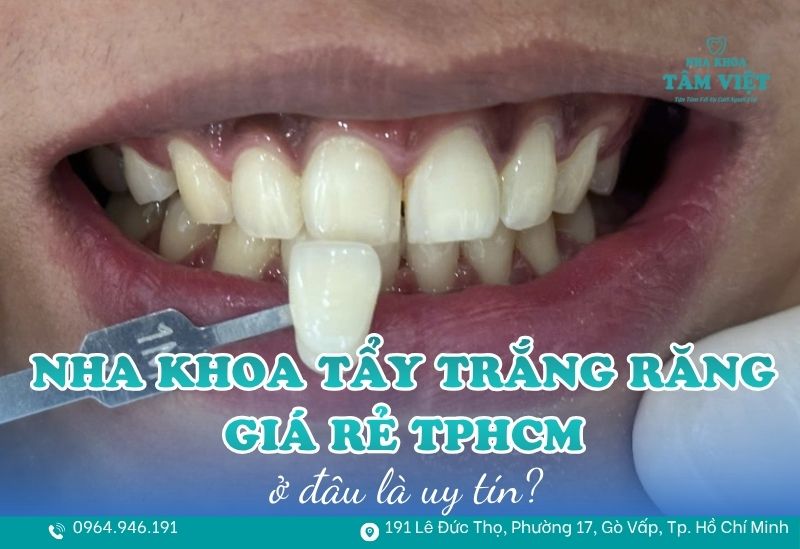 nha khoa tẩy trắng răng giá rẻ TPHCM