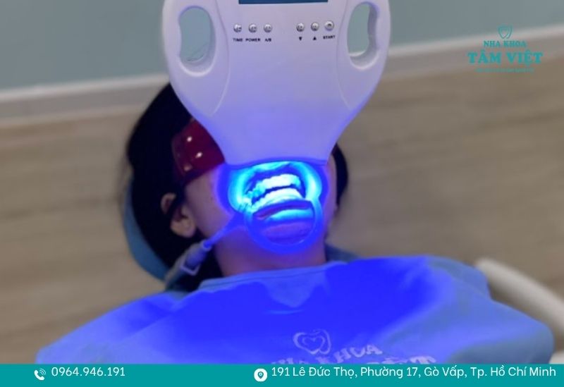 Công nghệ Laser Whitening tại Nha khoa Tâm Việt