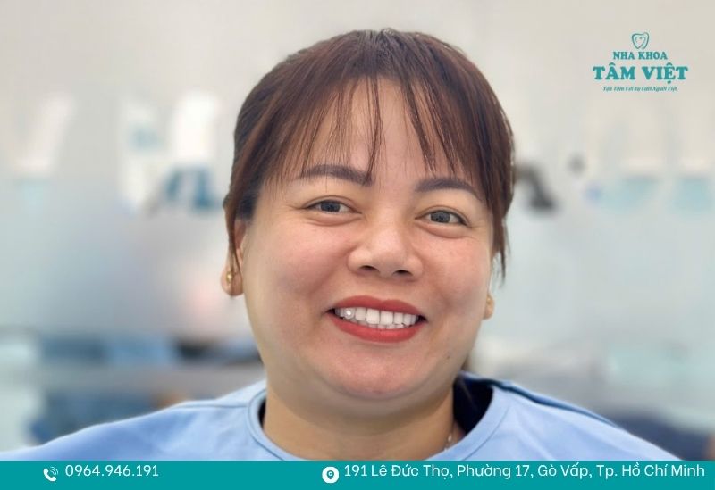 Nha khoa thẩm mỹ Gò Vấp uy tín và đa dạng dịch vụ 5 Hình ảnh khách hàng bọc răng sứ tại Nha khoa Tâm Việt