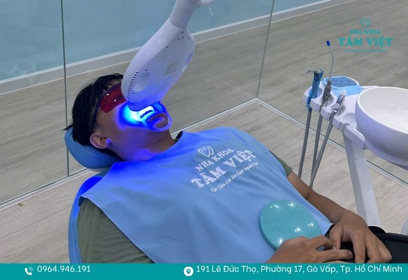 Tẩy trắng răng 1 lần được không? Sự thật bạn cần biết 4 Thời gian chiếu đèn được kiểm soát theo từng trường hợp